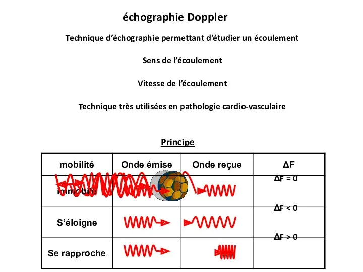 échographie Doppler Principe Technique d’échographie permettant d’étudier un écoulement Sens de l’écoulement Vitesse