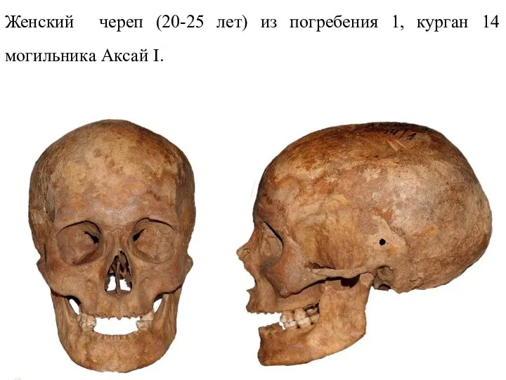 Женский череп (20-25 лет) из погребения 1, курган 14 могильника Аксай I.