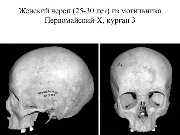 Женский череп (25-30 лет) из могильника Первомайский-X, курган 3