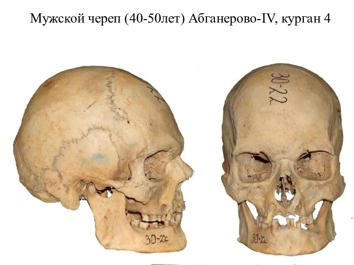 Мужской череп (40-50лет) Абганерово-IV, курган 4