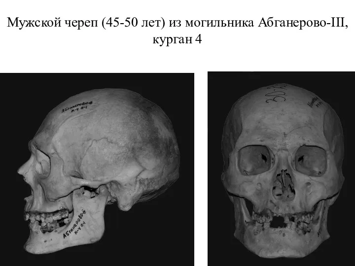 Мужской череп (45-50 лет) из могильника Абганерово-III, курган 4