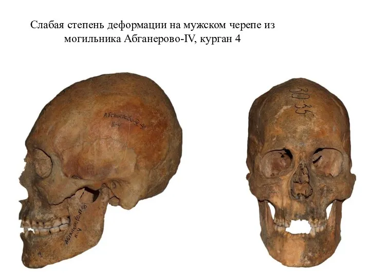 Слабая степень деформации на мужском черепе из могильника Абганерово-IV, курган 4