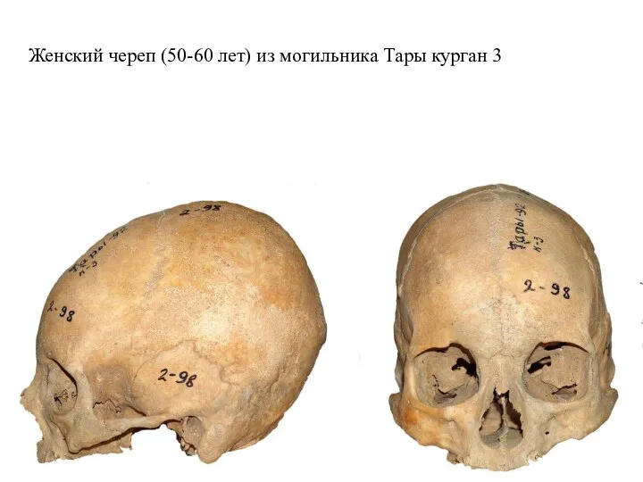 Женский череп (50-60 лет) из могильника Тары курган 3