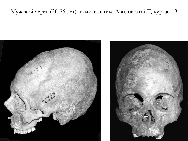 Мужской череп (20-25 лет) из могильника Авиловский-II, курган 13