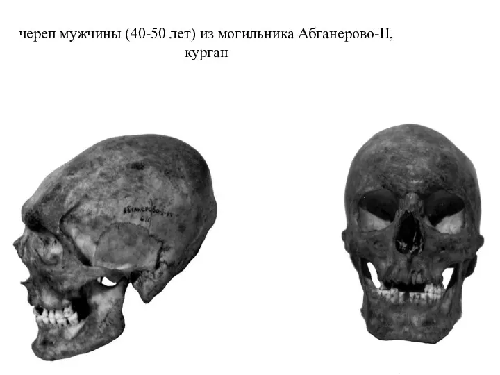 череп мужчины (40-50 лет) из могильника Абганерово-II, курган