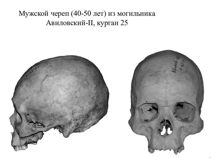 Мужской череп (40-50 лет) из могильника Авиловский-II, курган 25