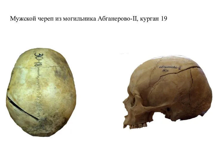 Мужской череп из могильника Абганерово-II, курган 19