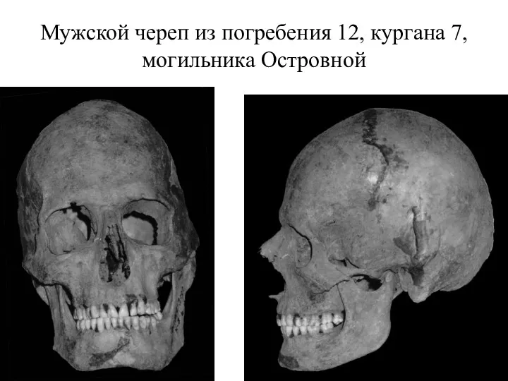 Мужской череп из погребения 12, кургана 7, могильника Островной