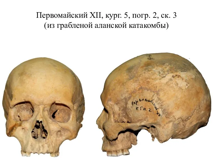 Первомайский XII, кург. 5, погр. 2, ск. 3 (из грабленой аланской катакомбы)