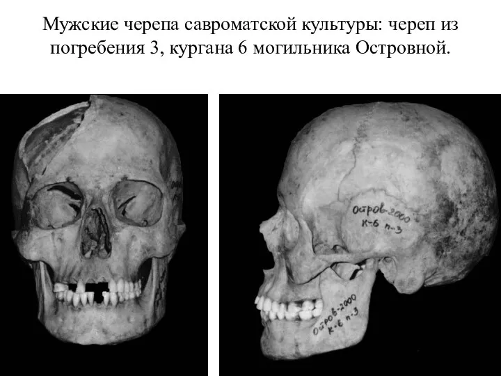 Мужские черепа савроматской культуры: череп из погребения 3, кургана 6 могильника Островной.