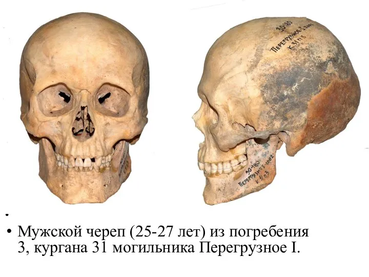 Мужской череп (25-27 лет) из погребения 3, кургана 31 могильника Перегрузное I.