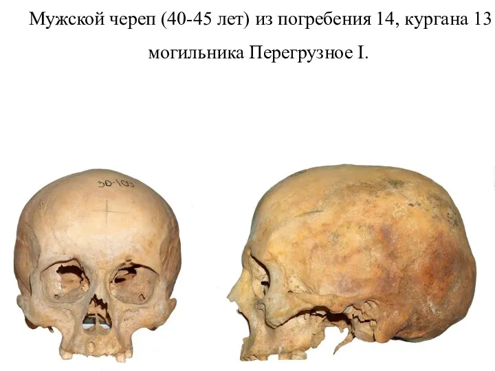 Мужской череп (40-45 лет) из погребения 14, кургана 13 могильника Перегрузное I.