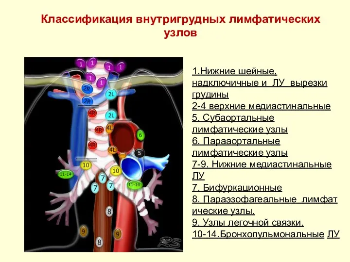 Классификация внутригрудных лимфатических узлов 1.Нижние шейные, надключичные и ЛУ вырезки