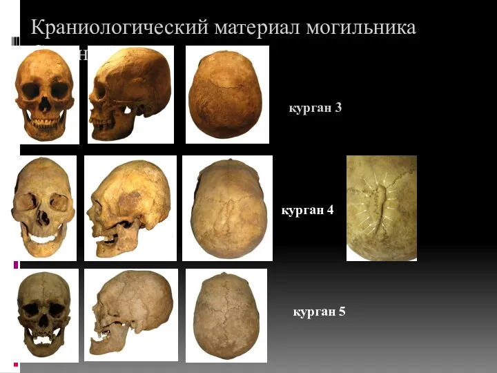 Краниологический материал могильника Соленый Дол курган 3 курган 4 курган 5