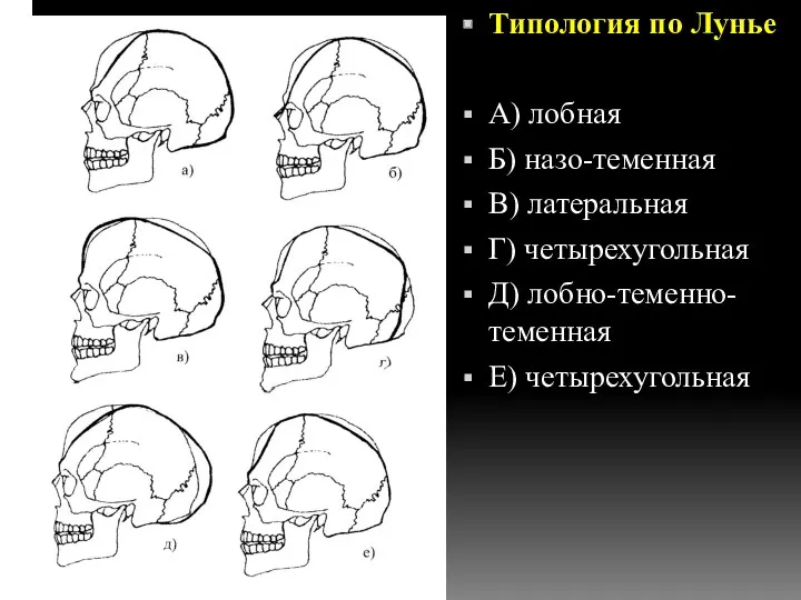 Типология по Лунье А) лобная Б) назо-теменная В) латеральная Г) четырехугольная Д) лобно-теменно-теменная Е) четырехугольная