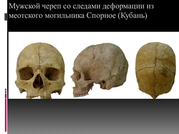 Мужской череп со следами деформации из меотского могильника Спорное (Кубань)