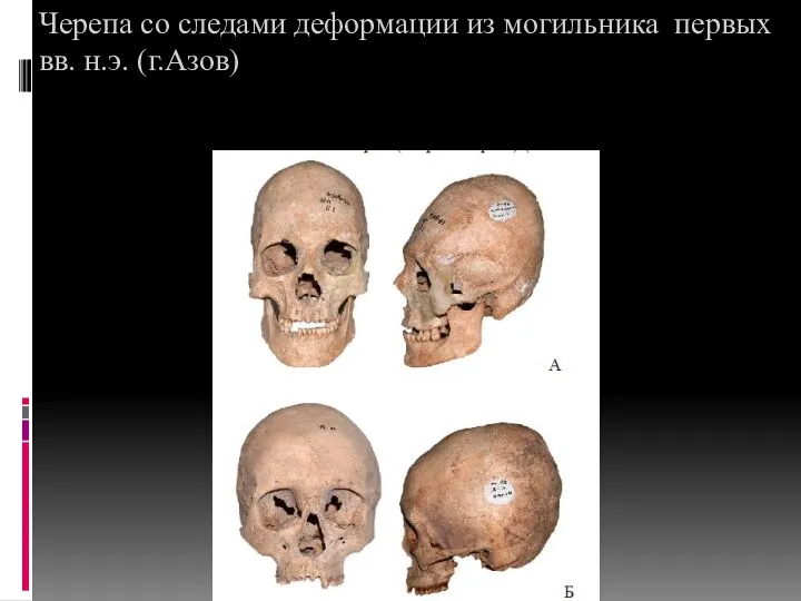 Черепа со следами деформации из могильника первых вв. н.э. (г.Азов)