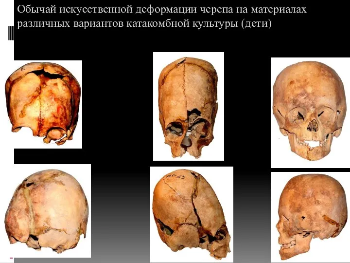 Обычай искусственной деформации черепа на материалах различных вариантов катакомбной культуры (дети) 2 3