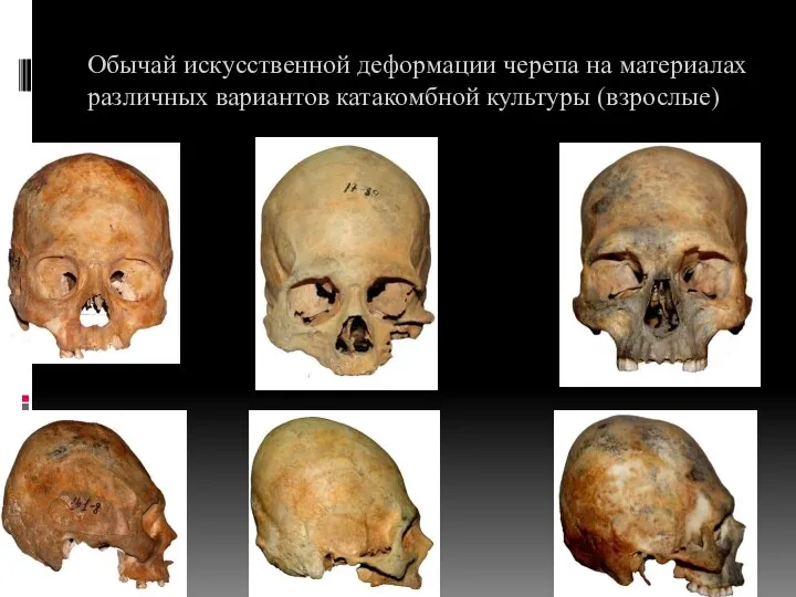 Обычай искусственной деформации черепа на материалах различных вариантов катакомбной культуры (взрослые) 3