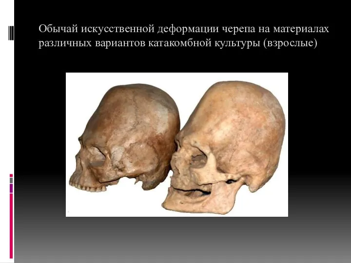 Обычай искусственной деформации черепа на материалах различных вариантов катакомбной культуры (взрослые)