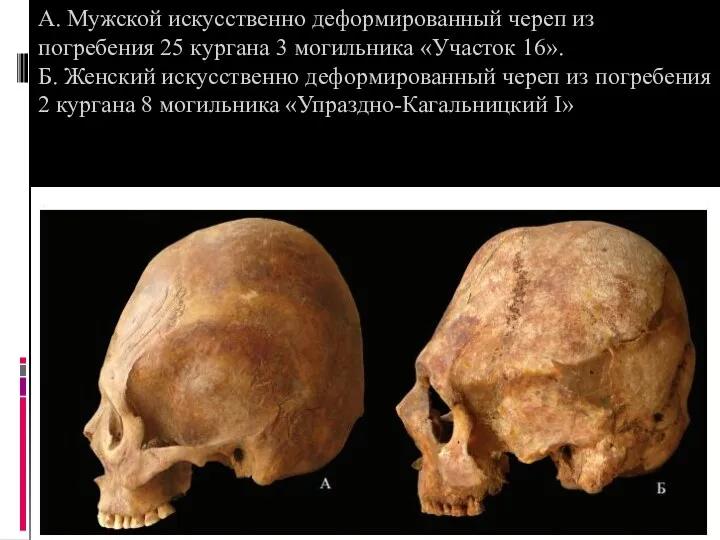 А. Мужской искусственно деформированный череп из погребения 25 кургана 3
