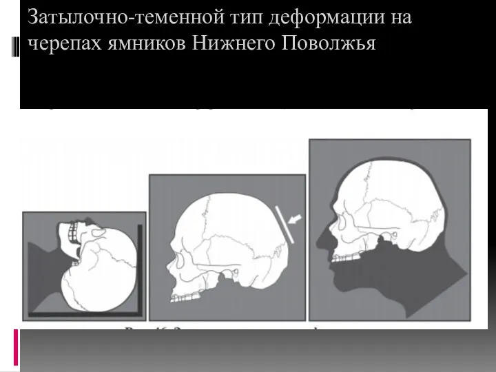 Затылочно-теменной тип деформации на черепах ямников Нижнего Поволжья