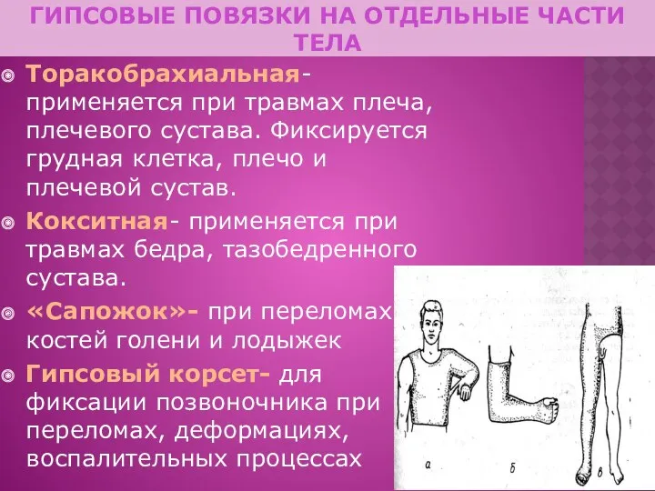 ГИПСОВЫЕ ПОВЯЗКИ НА ОТДЕЛЬНЫЕ ЧАСТИ ТЕЛА Торакобрахиальная- применяется при травмах