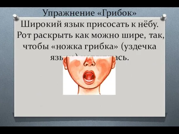 Упражнение «Грибок» Широкий язык присосать к нёбу. Рот раскрыть как можно шире, так,