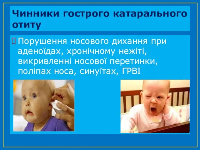 Чинники гострого катарального отиту Порушення носового дихання при аденоїдах, хронічному