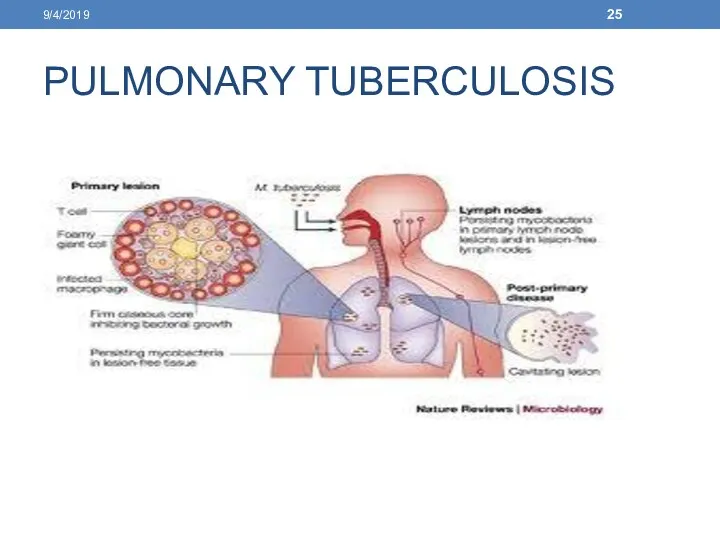 PULMONARY TUBERCULOSIS 9/4/2019