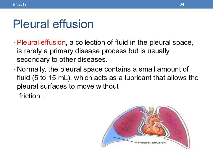 Pleural effusion Pleural effusion, a collection of fluid in the pleural space, is