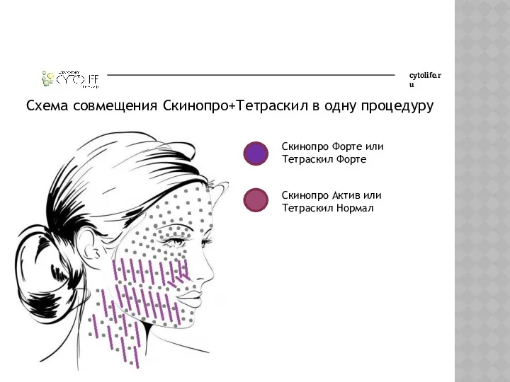 cytolife.ru Схема совмещения Скинопро+Тетраскил в одну процедуру Скинопро Форте или