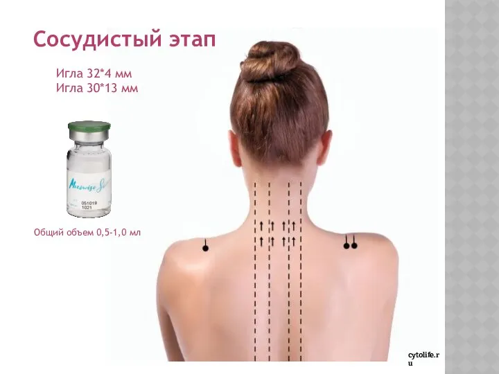 cytolife.ru Сосудистый этап Игла 32*4 мм Игла 30*13 мм Общий объем 0,5-1,0 мл
