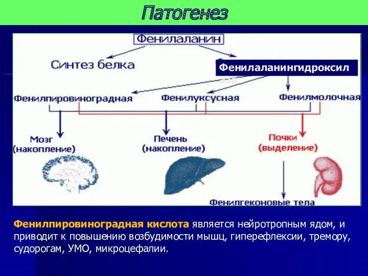 Патогенез Фенилпировиноградная кислота является нейротропным ядом, и приводит к повышению