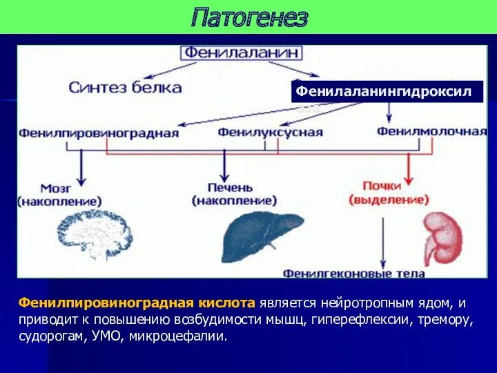 Патогенез Фенилпировиноградная кислота является нейротропным ядом, и приводит к повышению возбудимости мышц, гиперефлексии,