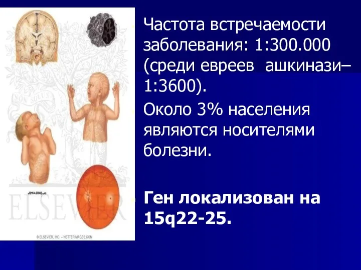 Частота встречаемости заболевания: 1:300.000 (среди евреев ашкинази– 1:3600). Около 3% населения являются носителями