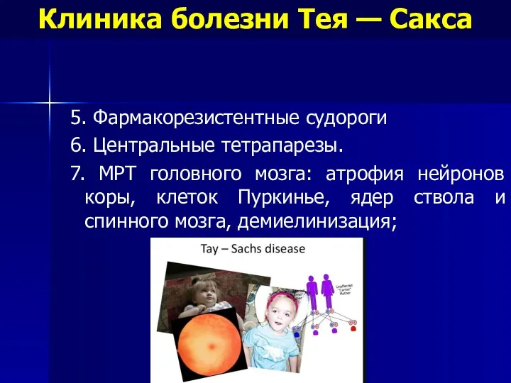 5. Фармакорезистентные судороги 6. Центральные тетрапарезы. 7. МРТ головного мозга: