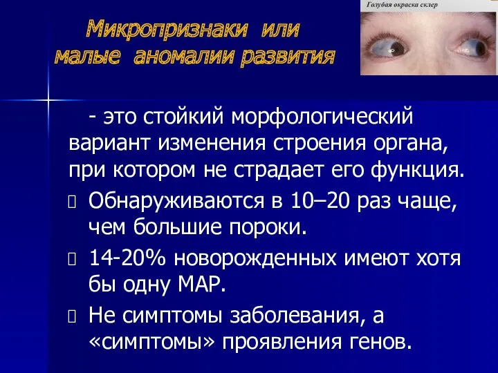 Микропризнаки или малые аномалии развития - это стойкий морфологический вариант изменения строения органа,