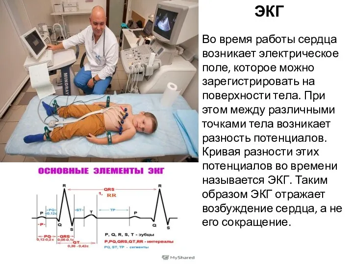 ЭКГ Во время работы сердца возникает электрическое поле, которое можно зарегистрировать на поверхности