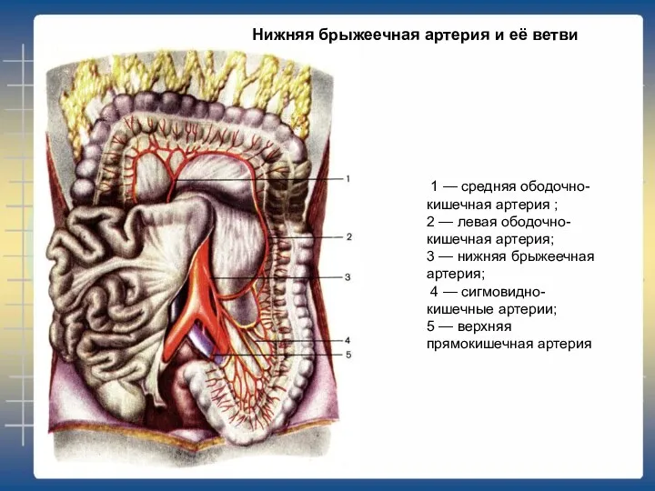 1 — средняя ободочно-кишечная артерия ; 2 — левая ободочно-кишечная