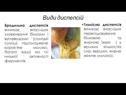 Види диспепсій Бродильна диспепсія виникає внаслідок зловживання білками і вуглеводами