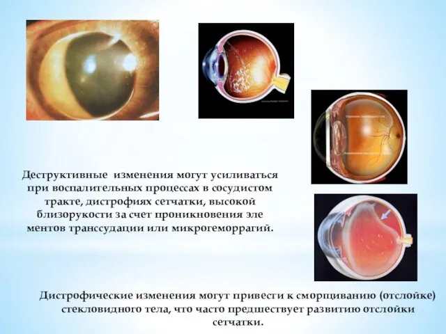 Деструктивные изменения могут усиливаться при воспалитель­ных процессах в сосудистом тракте, дистрофиях сетчат­ки, высокой