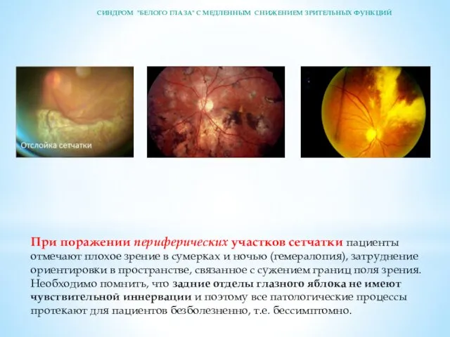 При поражении периферических участков сетчатки пациенты отмечают плохое зрение в сумерках и ночью