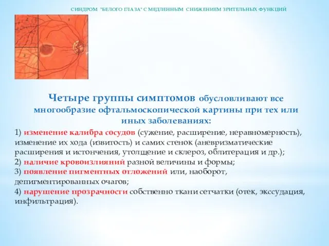 Четыре группы симптомов обусловливают все многообразие офтальмоскопической кар­тины при тех