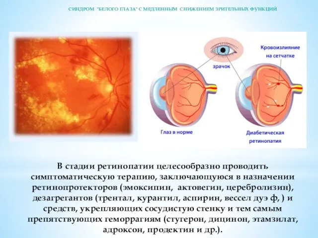 В стадии ретинопатии целесообразно проводить симптоматическую терапию, заключающуюся в назна­чении ретинопротекторов (эмоксипин, актовегин,