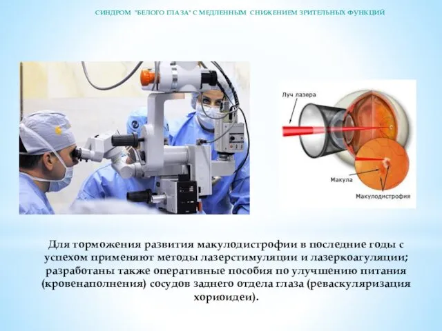 Для торможения развития макулодистрофии в последние годы с успехом применяют методы лазерстимуляции и