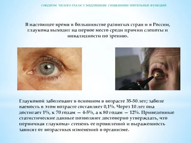 В настоящее время в большинстве развитых стран и в России, глаукома выходит на