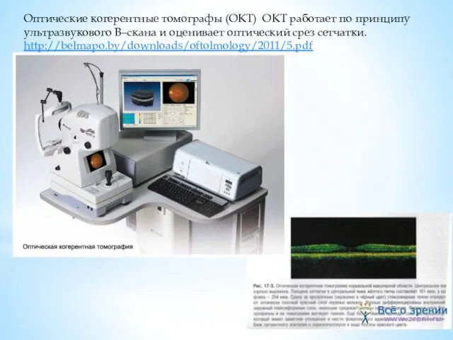 Оптические когерентные томографы (ОКТ) ОКТ работает по принципу ультразвукового B–скана и оценивает оптический срез сетчатки. http://belmapo.by/downloads/oftolmology/2011/5.pdf