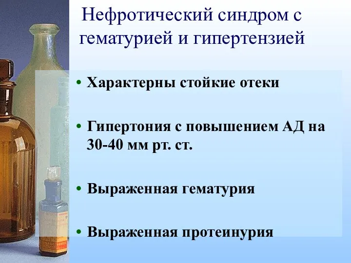 Нефротический синдром с гематурией и гипертензией Характерны стойкие отеки Гипертония