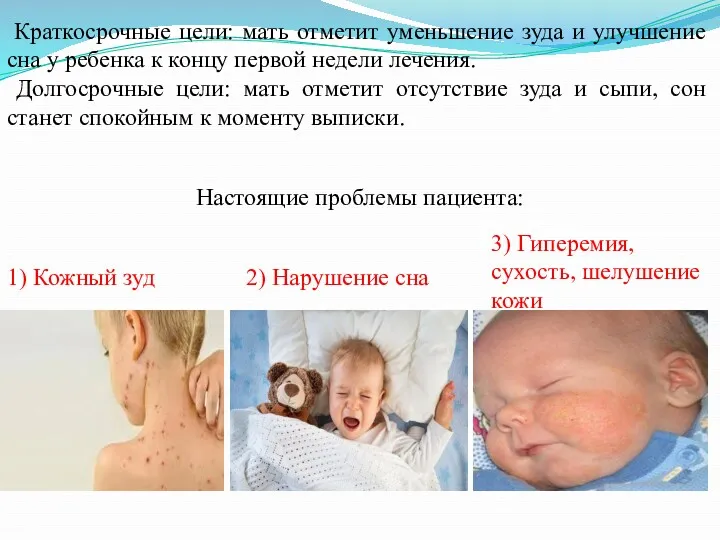 Настоящие проблемы пациента: 1) Кожный зуд 2) Нарушение сна 3) Гиперемия, сухость, шелушение
